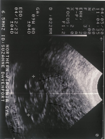 sonogram1-2.jpg