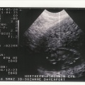sonogram1